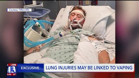 Utah Man Put In Medically Induced Coma From Vaping Related Lung Disease