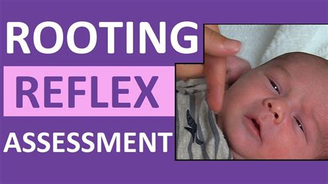 Rooting Reflex In Newborn Infant Baby Pediatric Nursing Assessment