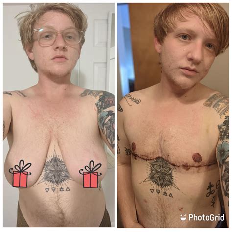 Shemale Sex Change Before After Sex Pictures Pass