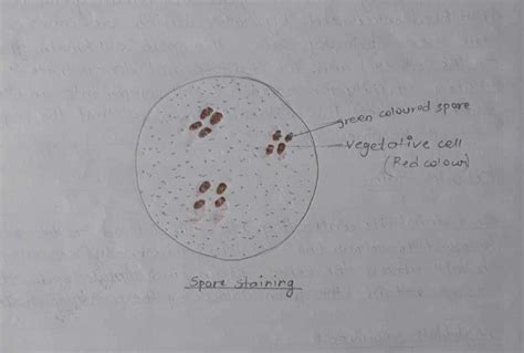 Study of Spore Staining: Procedure, Types, and Diagrams - All Bachelor