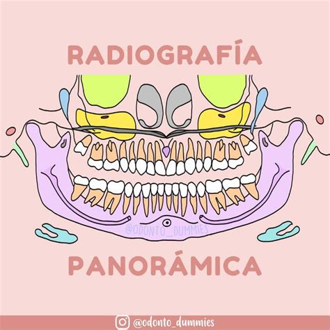 Partes de la Radiografía Panorámica ODONTO DUMMIES uDocz