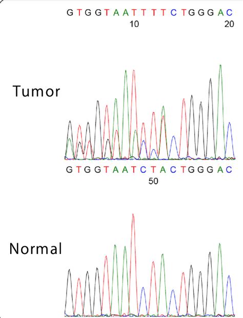 Tp Mutation Analysis Of Hgsc A Dna Sequence Analysis Of Tp Exon