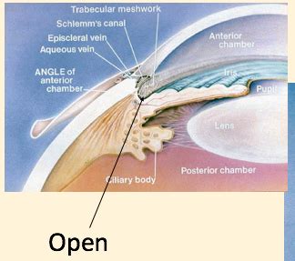 Glaucoma Flashcards Quizlet