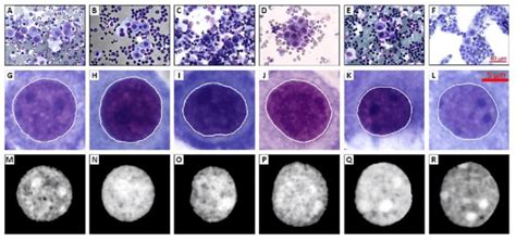 Example Images Showing Segmentation Process First Row Af Shows