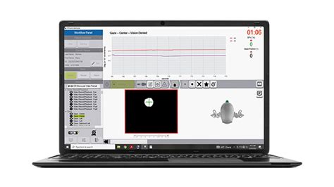 ICS Impulse Test De La Fonction Vestibulaire Natus