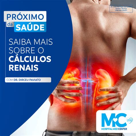 Hospital Medcenter Saiba Mais Sobre C Lculos Renais