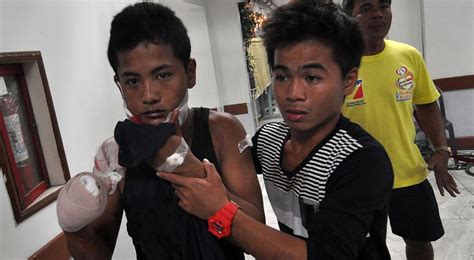 Firecracker Injuries Breaches Mark Inquirer News