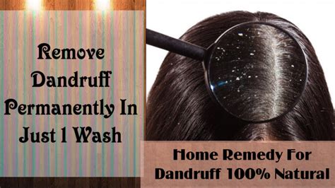 How To Get Rid Of Dandruff Permanently Home Remedy For Dandruff