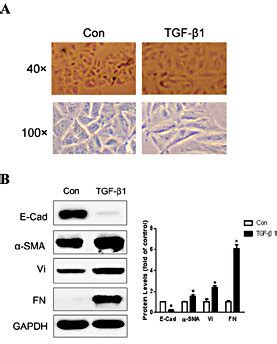 Tgf Induced Emt In A Cells A Cells Were Exposed To Ng Ml