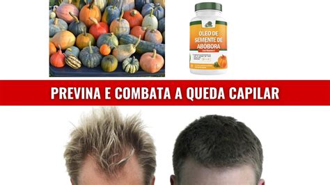 Em Apenas Dias Minha Queda De Cabelo Diminuiu Esse Suplemento