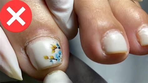 TransformaÇÃo Completa Das Unhas Dos PÉs Com Francesinhas Youtube