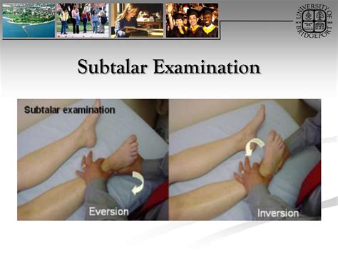 Ppt Ankle And Foot Orthopaedic Tests Orthopedics And Neurology Dx 612