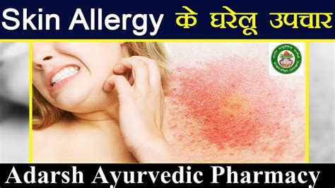 स्किन एलर्जी को आयुर्वेदिक उपचार से करें दूर Ayurveda Treatment For Skin Allergy Youtube