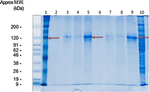 SDS PAGE Examination Results From Conditioned Media Harvested From