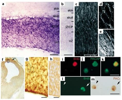 Pacap And Pac Expression In Developing Rat Cortex A In Situ