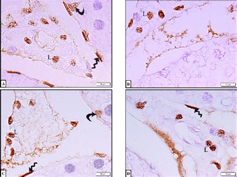 Photomicrographs Of Ar Immunostained Testicular Sections A Control