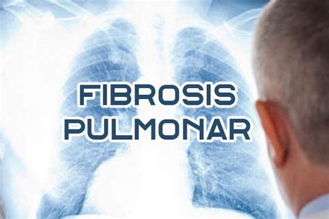 Qu Es La Fibrosis Pulmonar Cl Nica M Dica Porter