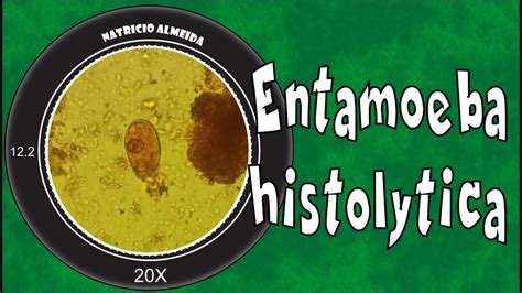 Entamoeba Histolytica Sintomas