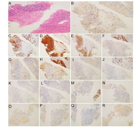 He And Immunohistochemical Stainings Of Puncture Liver Tissues He Download Scientific Diagram