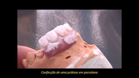 Miniatura Do Vídeo Laboratório De Prótese Dentária Dentro Da Clínica