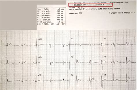 Dr Smiths Ecg Blog