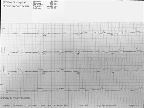 Ecg Guru Instructor Resources A Gathering Place For Instructors Of Ecg And Cardiac Topics