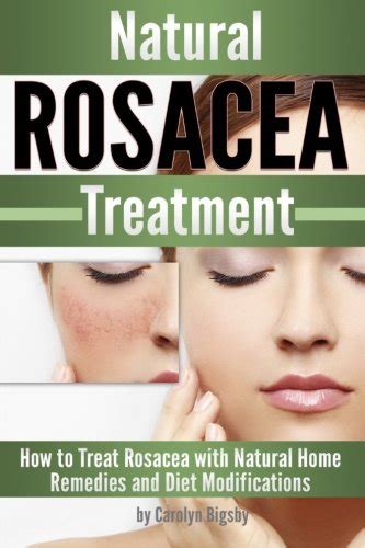 Natural Rosacea Treatment How To Treat Rosacea With Natural Home