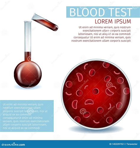 Ayuda Material Visual Del An Lisis De Sangre Para El Uso De La Cl Nica