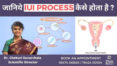 Iui Step By Step Iui Process Dr Chekuri