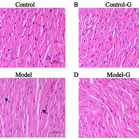 Effects Of G Acuta On The Histopathological Changes In The Heart