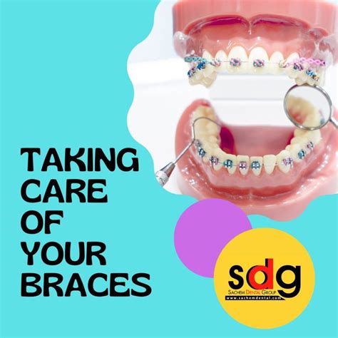 Top Tips for Taking Care of Braces