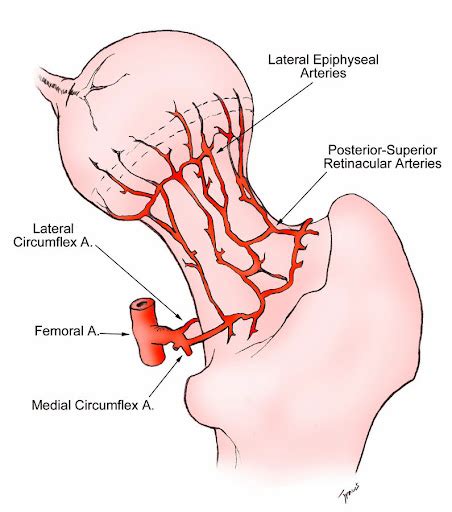 關節囊內骨折(intracapsular fracture) - 小小整理網站 Smallcollation