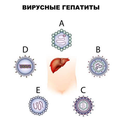 БОТКИН ЧТО ЗА ГЕПАТИТ