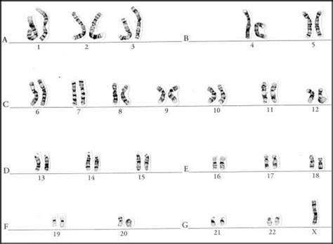 Solved Identify Any Chromosomal Abnormality By Looking At Chegg