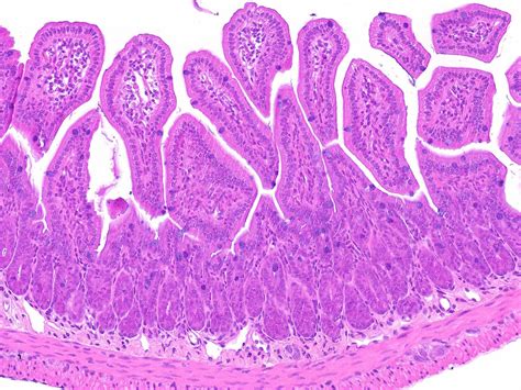 The Bacillus Cereus Toxin Alveolysin Disrupts The Intestinal