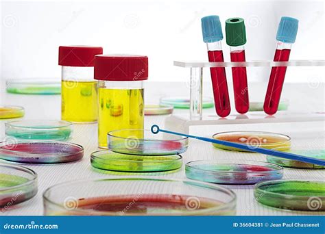 Blood Sample in Test Tubes and Petri Dishes Stock Image - Image of ...