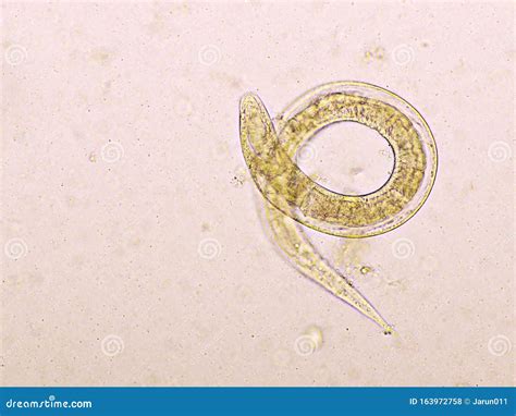 Strongyloides Stercoralis Or Threadworm In Human Stool Stock Photo