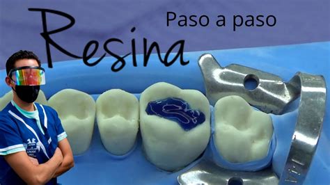 Como Hacer Una Resina Dental Paso A Paso YouTube