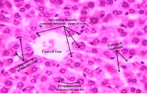 Liver Histology Kupffer Cells