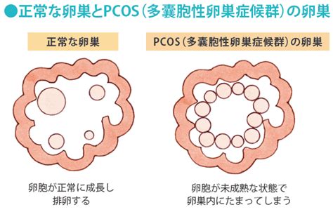 子宮内膜増殖症には触れず 不妊治療を続ける先生に 不信感を抱いています│【医師監修】ジネコ不妊治療情報