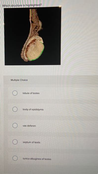 Solved Which Structure Is Highlighted Multiple Choice Chegg