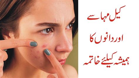 How To Remove Pimples Overnight Remove Dark Spots And Blackheads Youtube