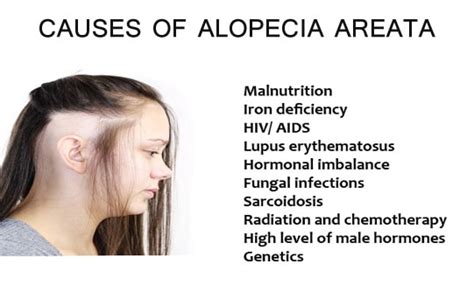 Everything You Need To Know About Alopecia Areata The Second Angle