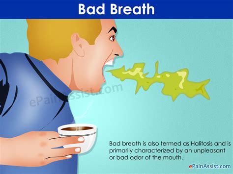 Causes Of Your Bad Breath Halitosis [nurses Diaries] Educative News Room