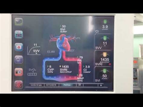 Hemodynamic Monitor Ev Youtube