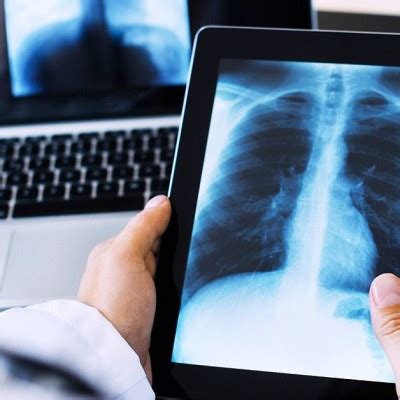 Como Funciona A Radiologia Digital