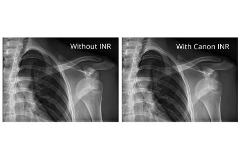 Cmcu Digital Radiography Dr Group Introduces Clinical White Paper On