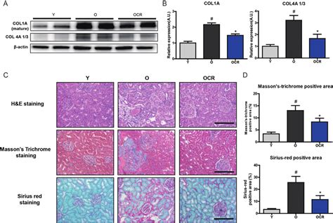 Changes Of MMP2 Substrate Extracellular Matrix Proteins And Fibrosis