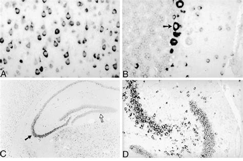 Progranulin Expression In Mouse Brain Progranulin Expression Was