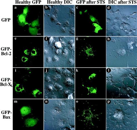 Distribution Of Gfp Fusion Proteins Expressed In Living Cos 7 Cells